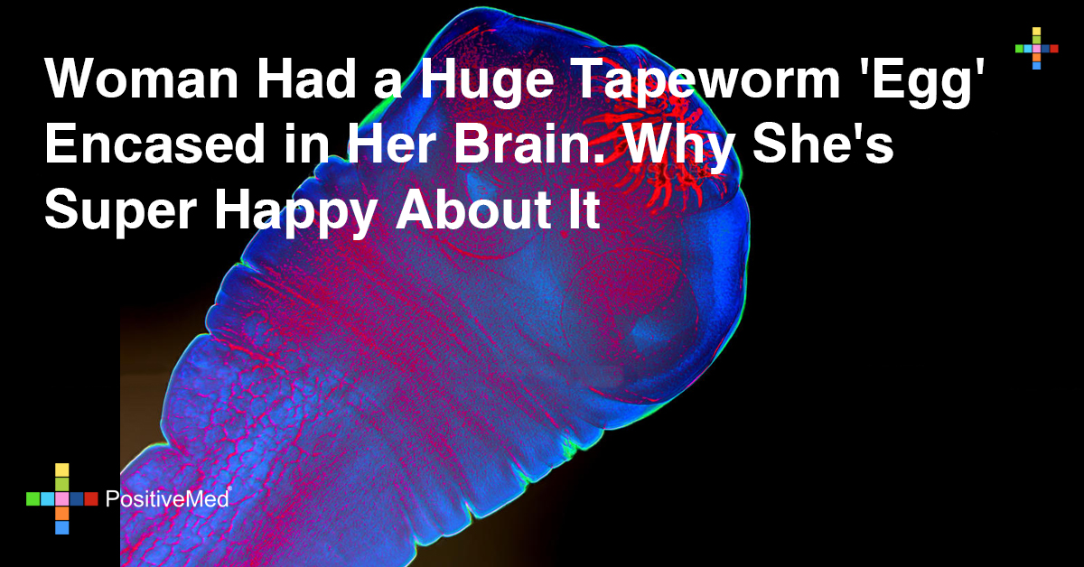 Woman Had a Huge Tapeworm 'Egg' Encased in Her Brain. Why She's Super Happy About It