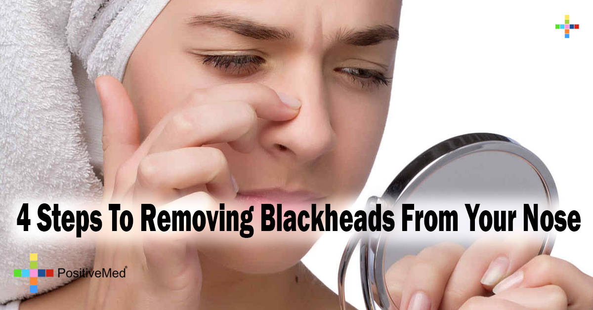 4 Steps To Removing Blackheads From Your Nose