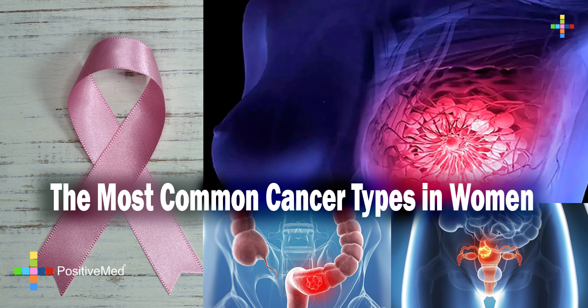 The Most Common Cancer Types in Women