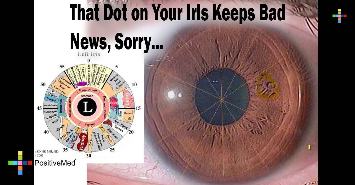 That Dot on Your Iris Keeps Bad News, Sorry...