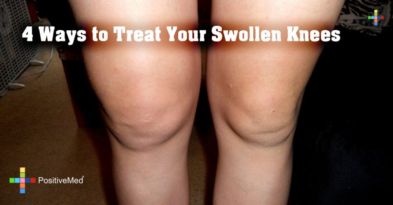 4 Ways To Treat Your Swollen Knees Positivemed