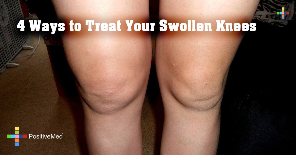 4 Ways to Treat Your Swollen Knees