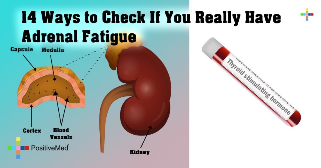 14-ways-to-check-if-you-really-have-adrenal-fatigue-positivemed