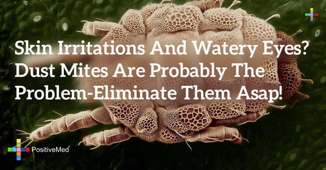 Marvelous Info About How To Eliminate Dust Mites