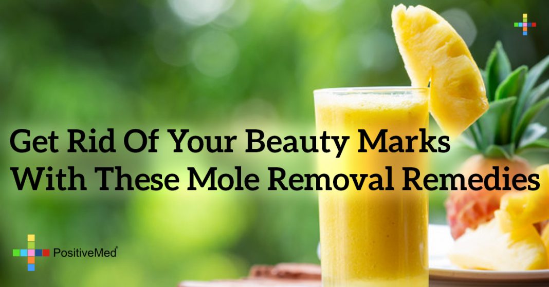 Get Rid of Your Beauty Marks With These Mole Removal Remedies - PositiveMed