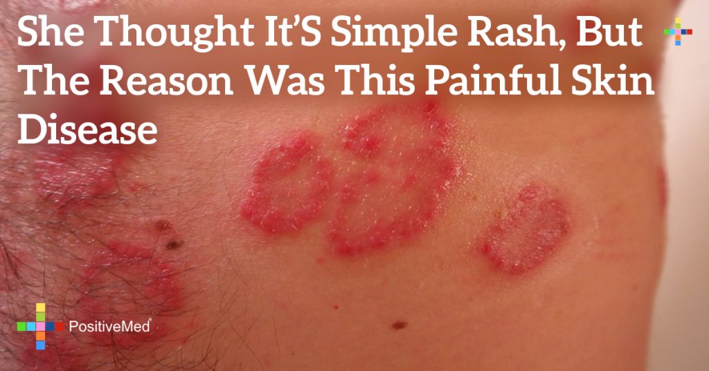 rash that hurts to touch and itchy
