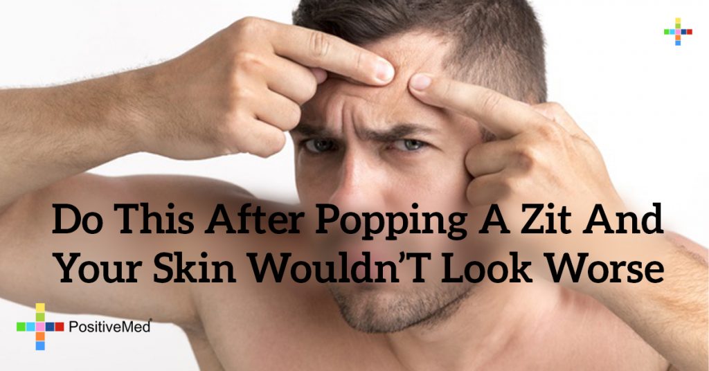 Do THIS After Popping a Zit and Your Skin Wouldn't Look Worse - PositiveMed