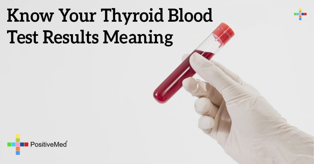 know-your-thyroid-blood-test-results-meaning-positivemed