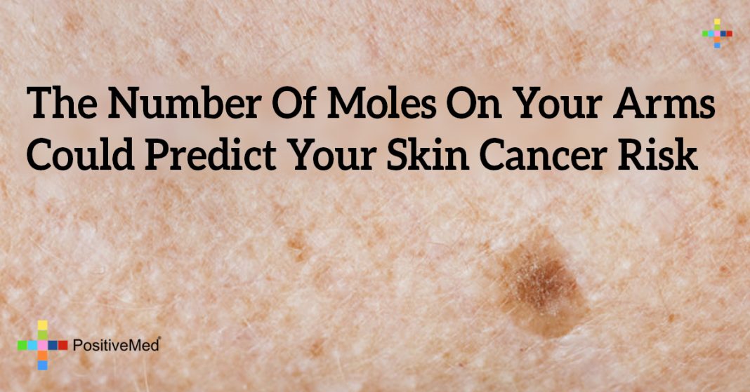 The Number Of Moles On Your Arms Could Predict Your Skin