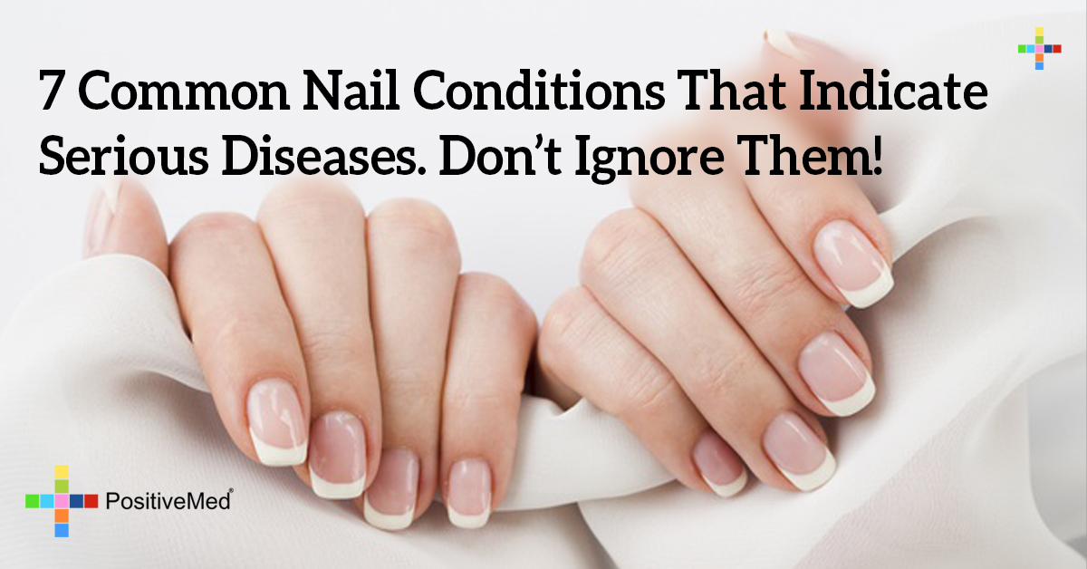 7 Common Nail Conditions That Indicate Serious Diseases. Don't Ignore Them!