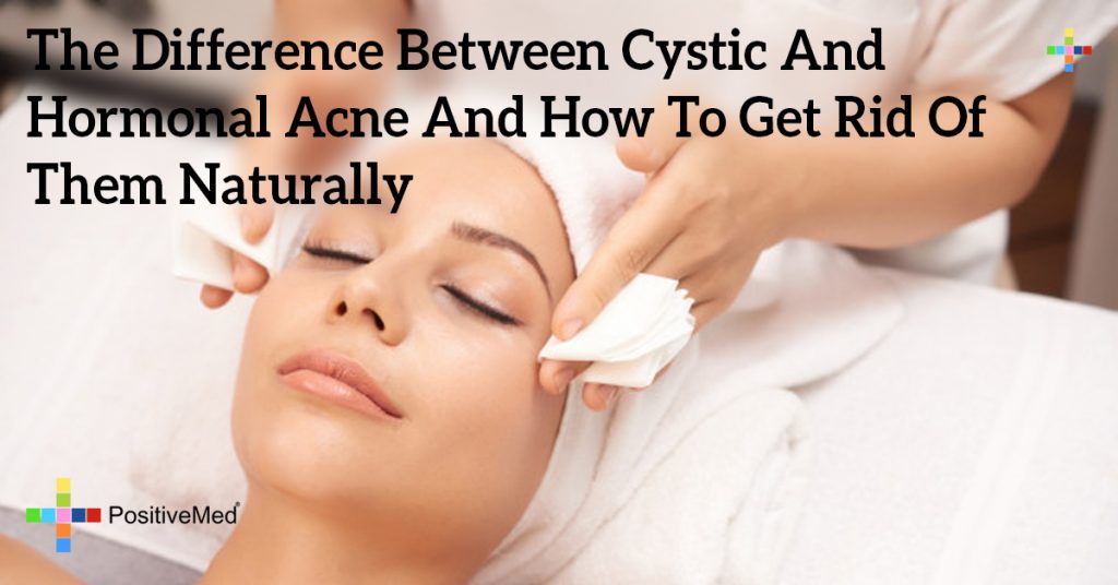 The Difference Between Cystic And Hormonal Acne And How To Get Rid Of 