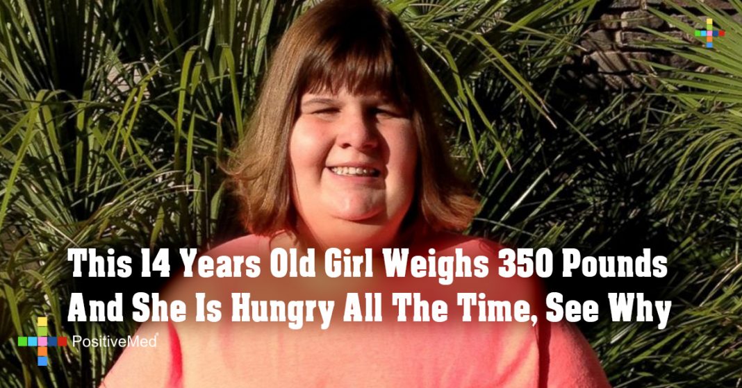 This 14 Years Old Girl Weighs 350 Pounds And She Is Hungry All The Time See Why