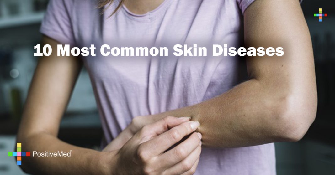 10-most-common-skin-disorders-diseases-in-humans-youtube