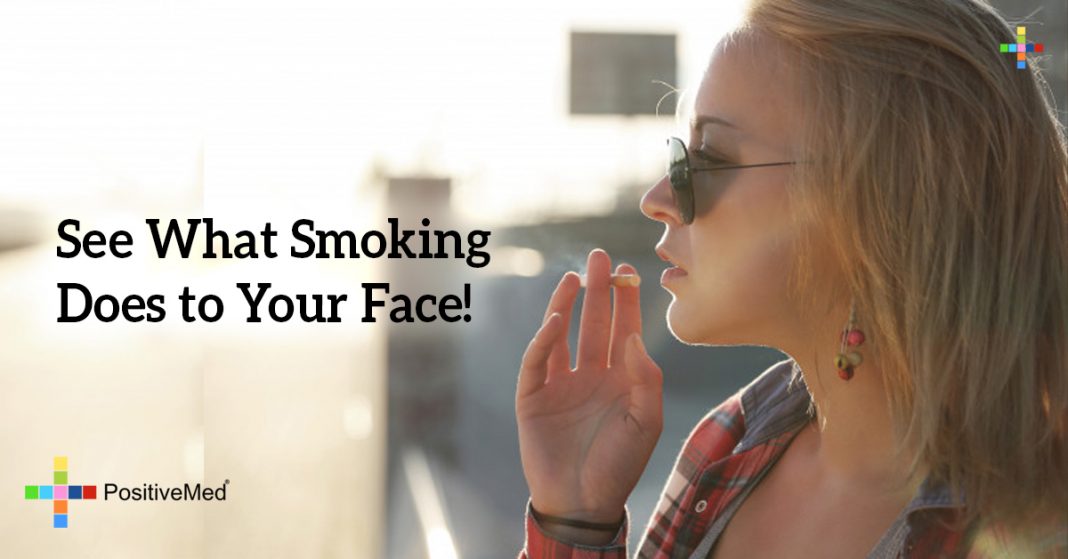 How Does Smoking Affect Your Face