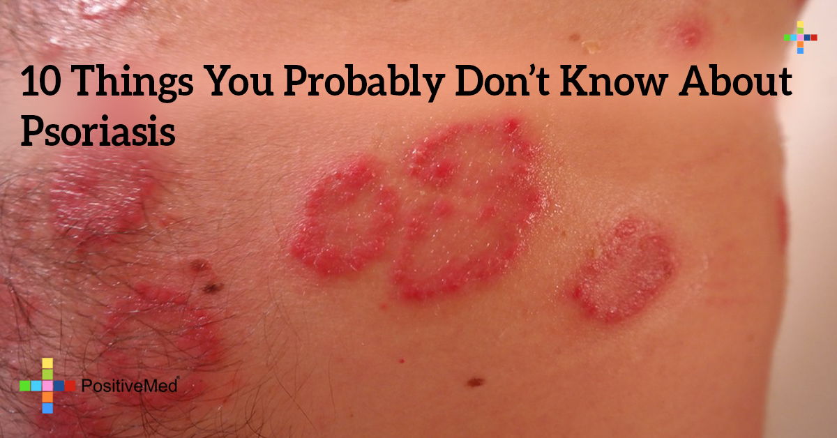 10 Things You Probably Don't Know About Psoriasis