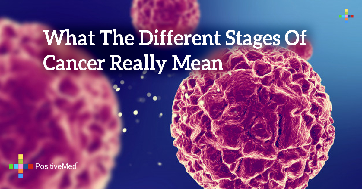 what-the-different-stages-of-cancer-really-mean