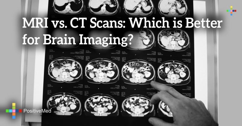 photocopy vs scan