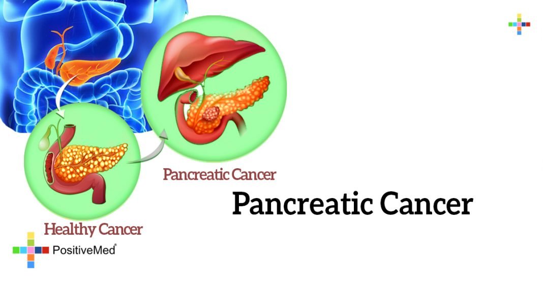 Pancreatic Cancer