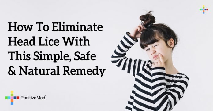 How To Eliminate Head Lice With This Simple Safe And Natural Remedy