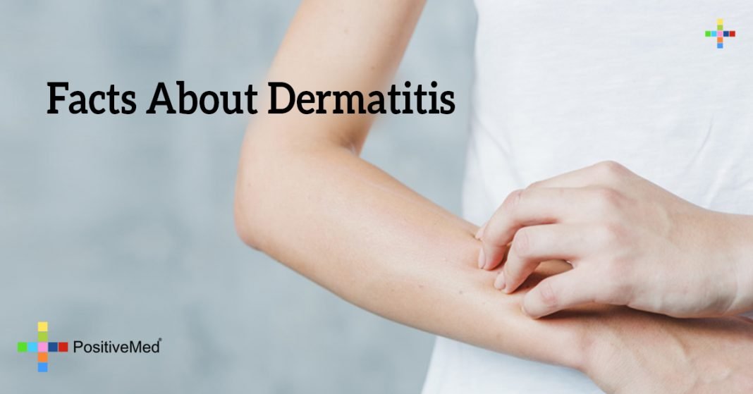 Facts About Dermatitis 9008