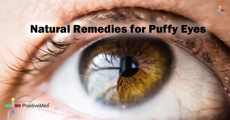 Natural Remedies For Puffy Eyes