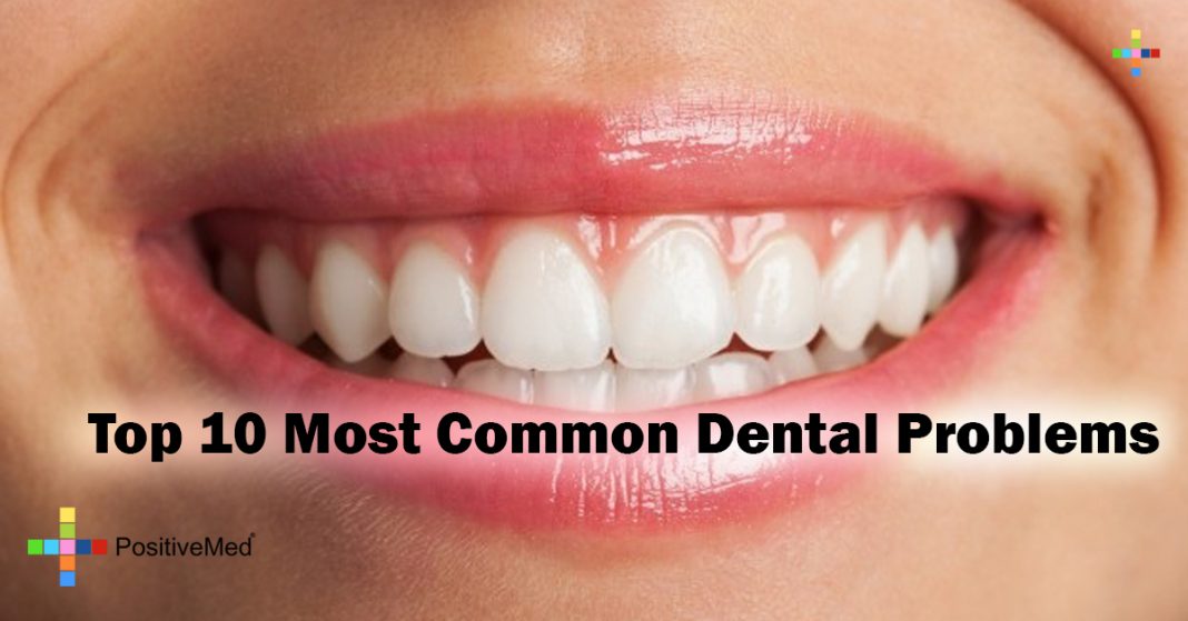 top-10-most-common-dental-problems-positivemed