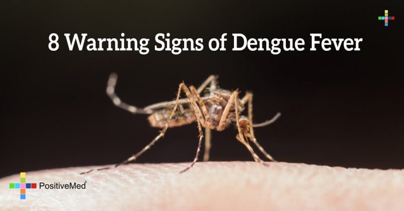 Dengue Fever Rash Features