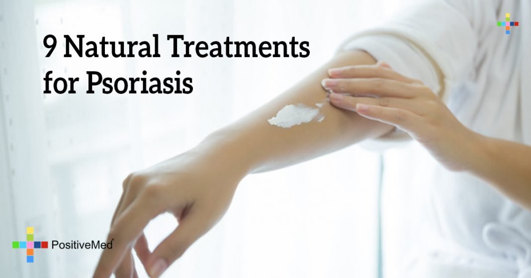 9 Natural Treatments For Psoriasis 