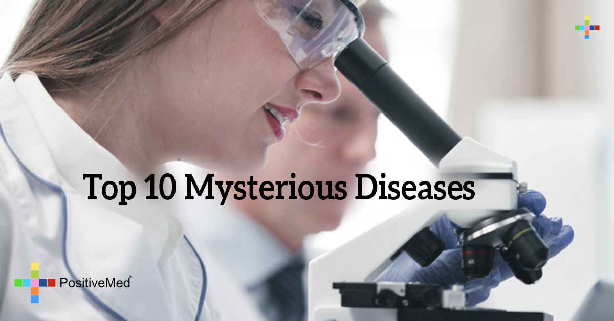 Top 10 Mysterious Diseases PositiveMed