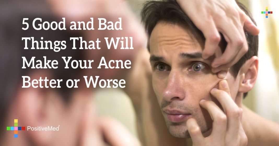 5 Good And Bad Things That Will Make Your Acne Better Or Worse