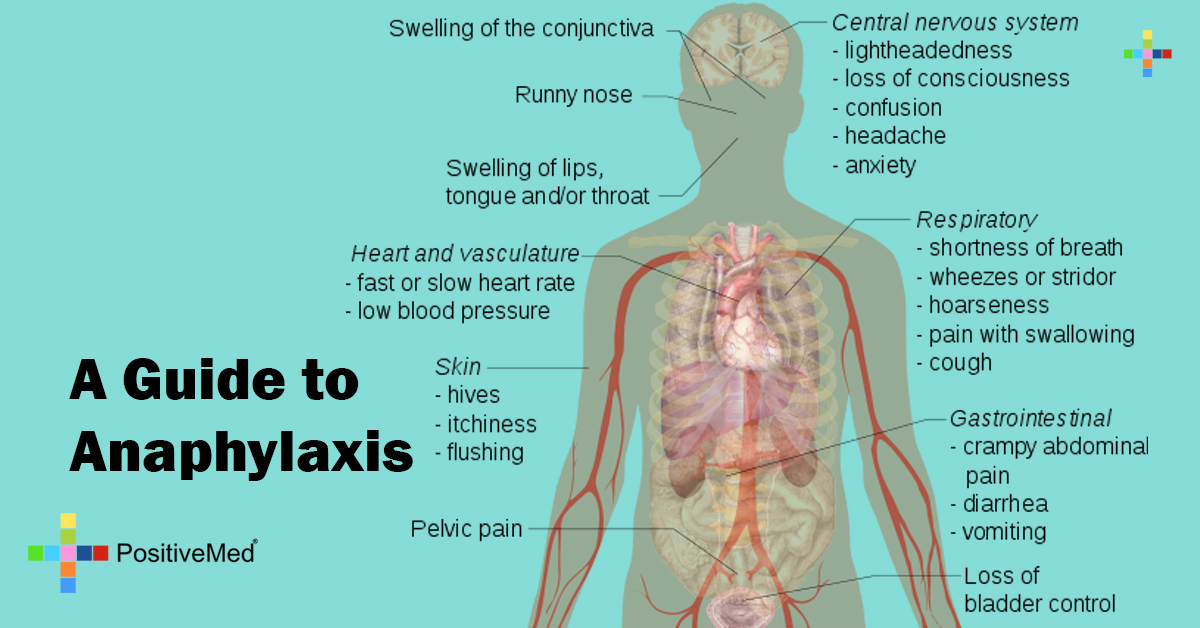 A Guide To Anaphylaxis