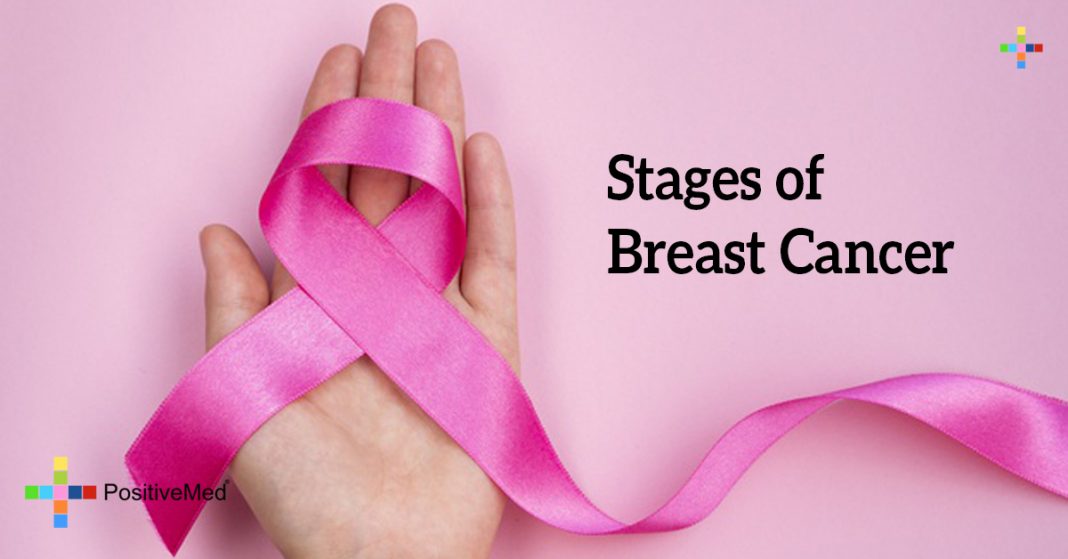 stages-of-breast-cancer