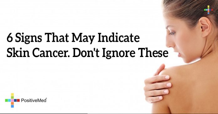 Indicate Skin Cancer