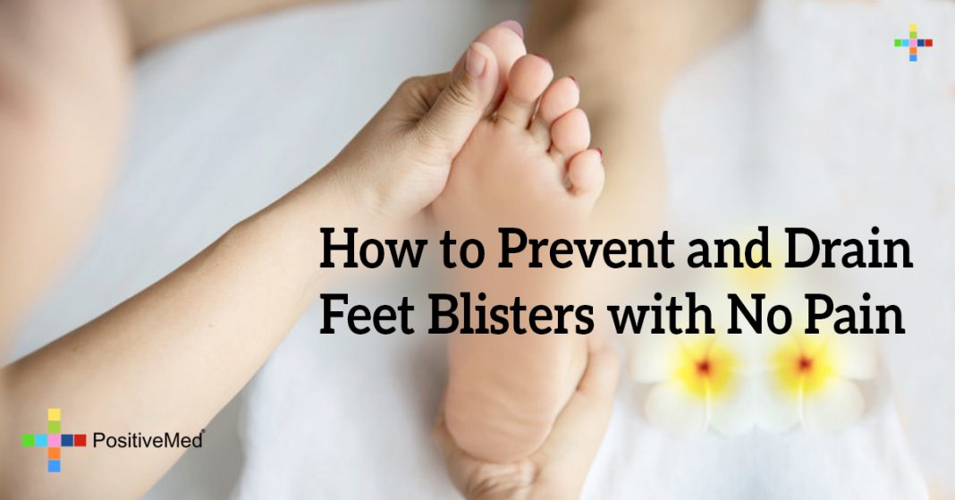 How To Prevent And Drain Feet Blisters With No Pain