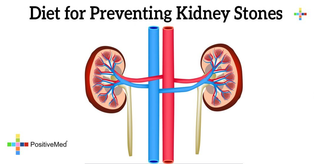 diet-for-preventing-kidney-stones