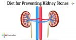  Diet for Preventing Kidney Stones 