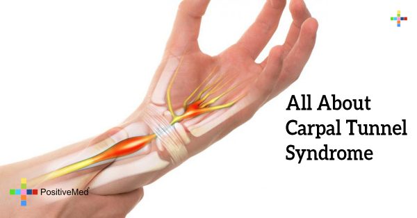 All About Carpal Tunnel Syndrome - PositiveMed