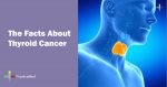 The Facts About Thyroid Cancer - PositiveMed