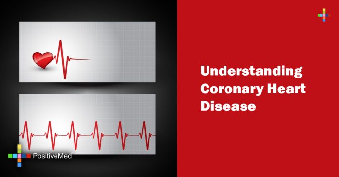 Understanding Coronary Heart Disease - PositiveMed