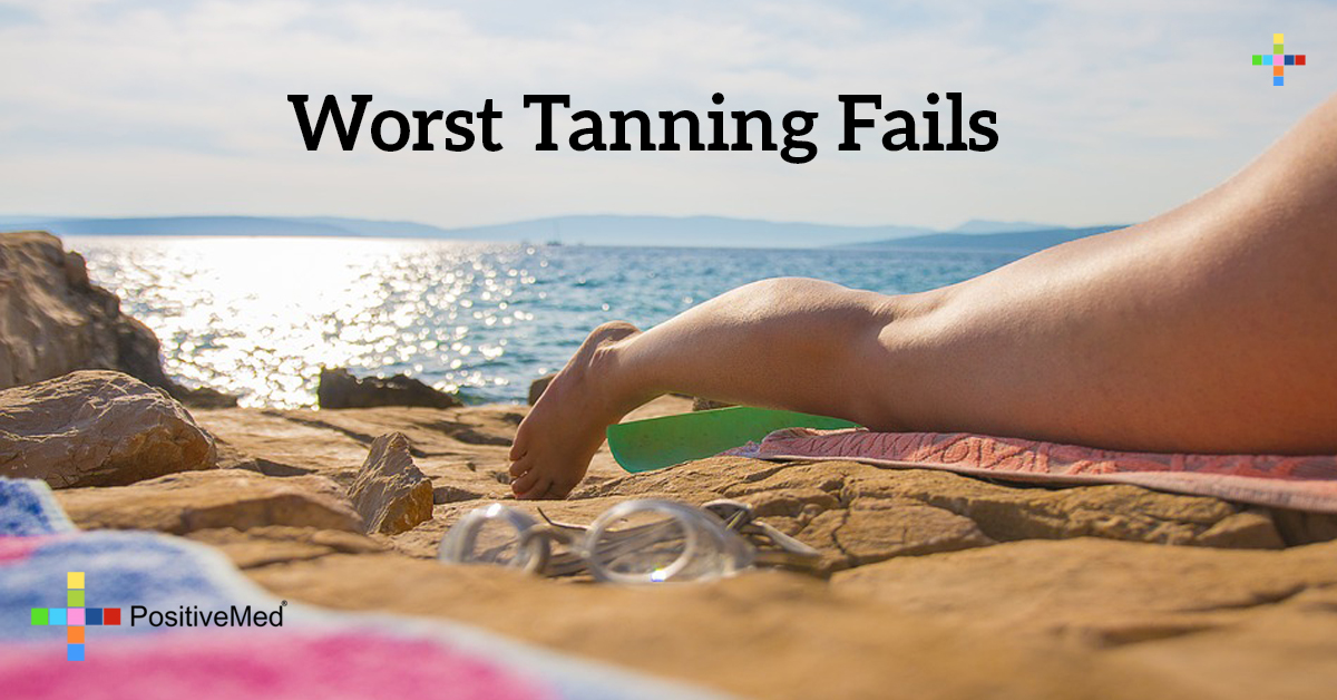 Worst Tanning Fails Positivemed