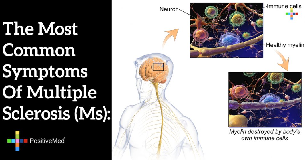 Multiple Sclerosis Common Symptoms And Diagnosis Opti - vrogue.co